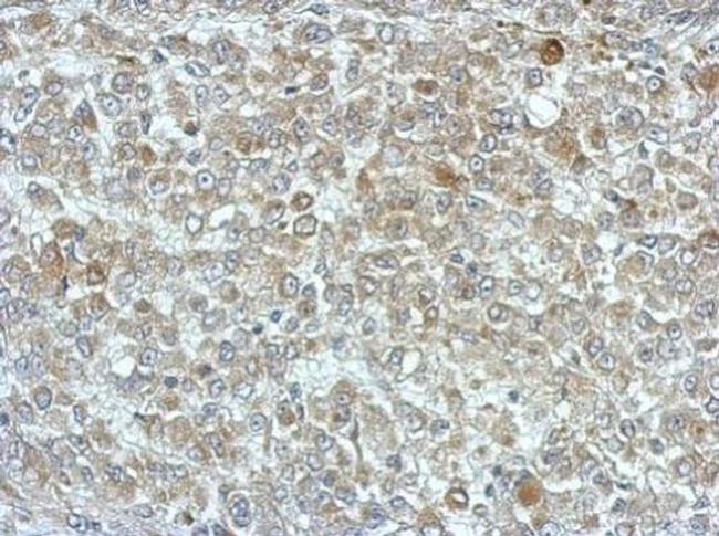 PPME1 Antibody in Immunohistochemistry (Paraffin) (IHC (P))