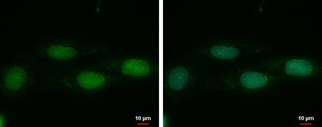 DNMT3L Antibody in Immunocytochemistry (ICC/IF)