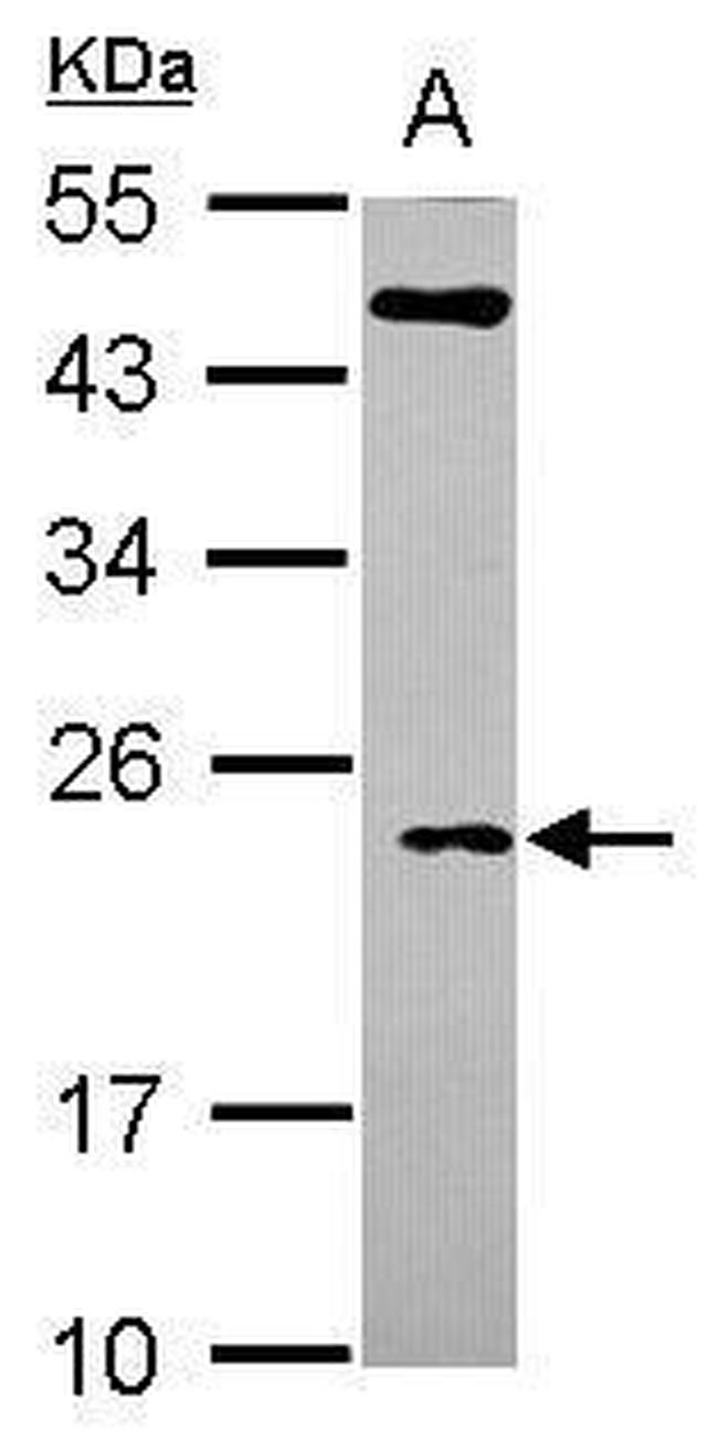 TC10 Antibody in Western Blot (WB)