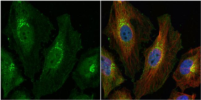 HGK Antibody in Immunocytochemistry (ICC/IF)