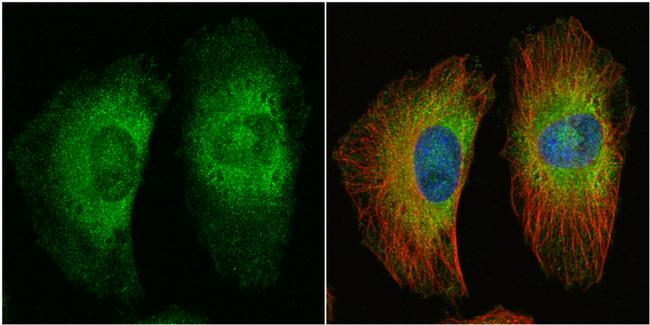 Protein APC Antibody in Immunocytochemistry (ICC/IF)