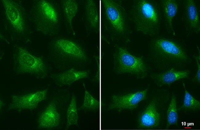 Presenilin 1 Antibody in Immunocytochemistry (ICC/IF)