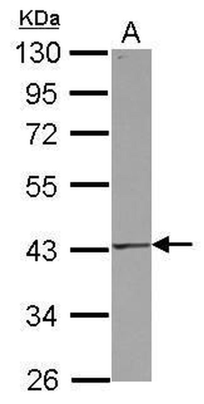 FAS Antibody in Western Blot (WB)