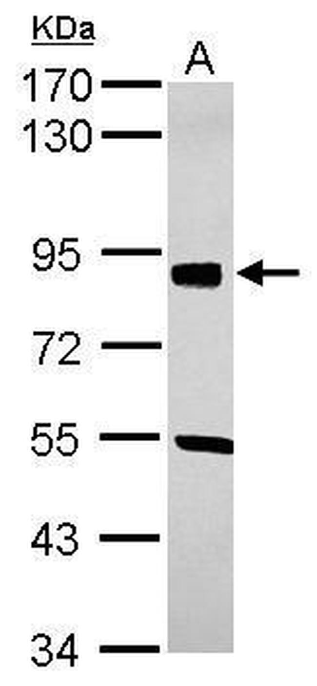 SOX6 Antibody in Western Blot (WB)