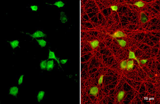 CXCL12 Antibody in Immunocytochemistry (ICC/IF)