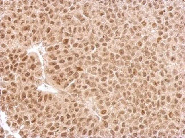 EXOSC3 Antibody in Immunohistochemistry (Paraffin) (IHC (P))