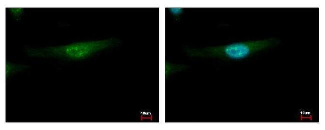 YBX2 Antibody in Immunocytochemistry (ICC/IF)