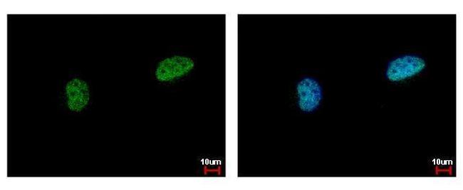 PIASy Antibody in Immunocytochemistry (ICC/IF)