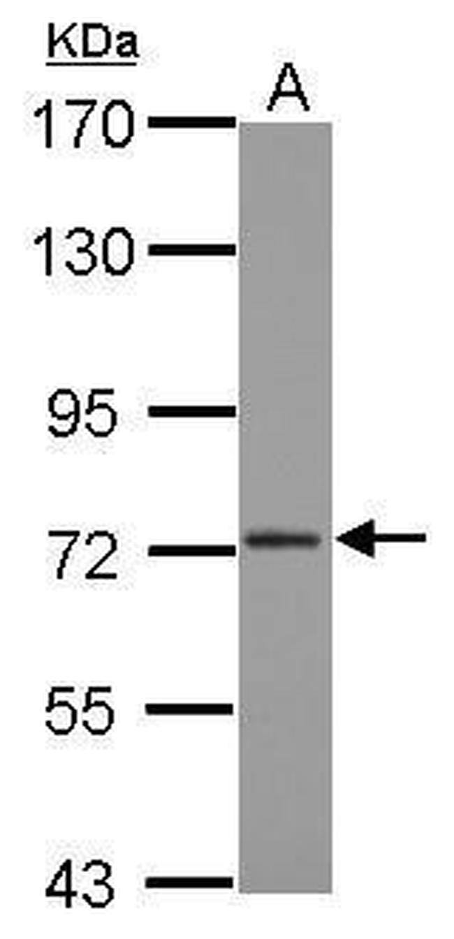 CPSF3 Antibody in Western Blot (WB)