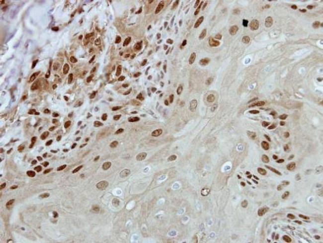 BRF2 Antibody in Immunohistochemistry (Paraffin) (IHC (P))