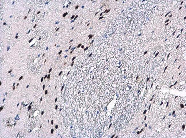 Macro H2A.2 Antibody in Immunohistochemistry (Paraffin) (IHC (P))