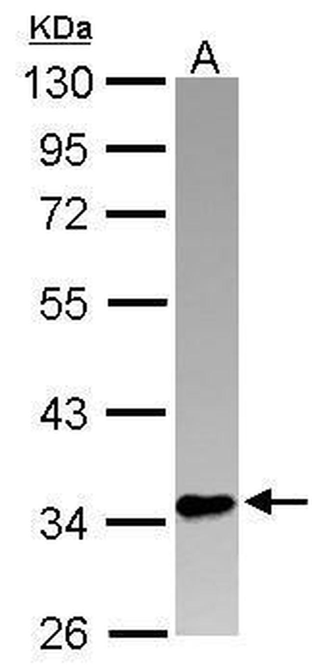 PINX1 Antibody in Western Blot (WB)