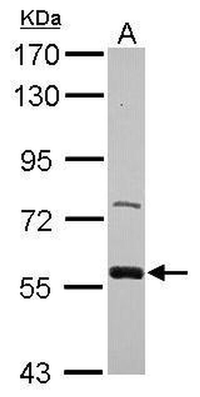 ZWILCH Antibody in Western Blot (WB)