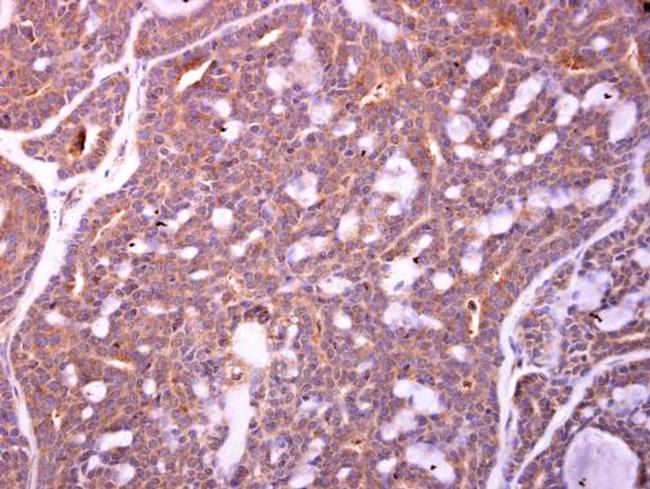 ZWILCH Antibody in Immunohistochemistry (Paraffin) (IHC (P))