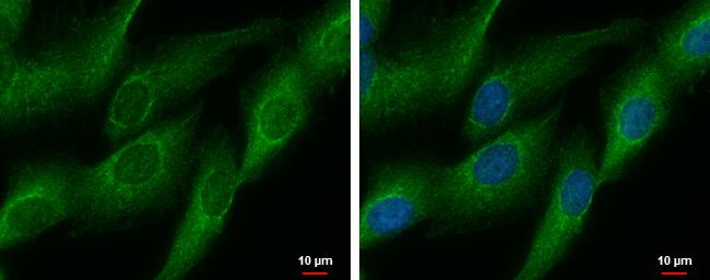 DDAH2 Antibody in Immunocytochemistry (ICC/IF)