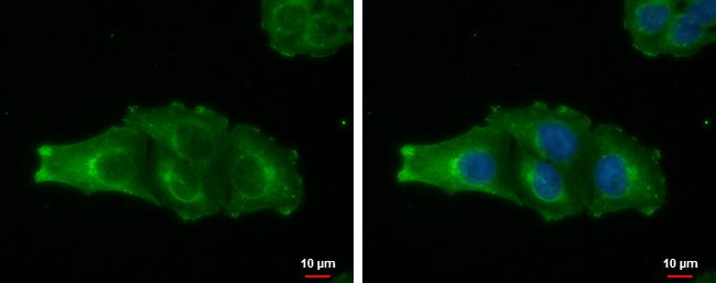 MAGEA4 Antibody in Immunocytochemistry (ICC/IF)