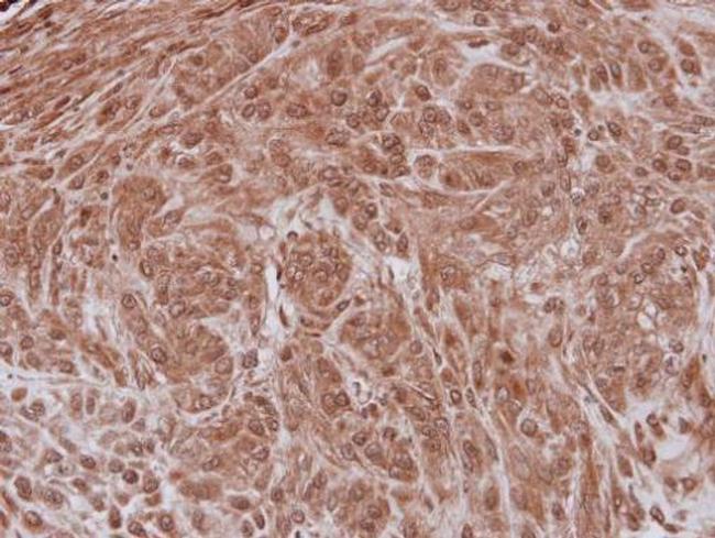 NXF3 Antibody in Immunohistochemistry (Paraffin) (IHC (P))