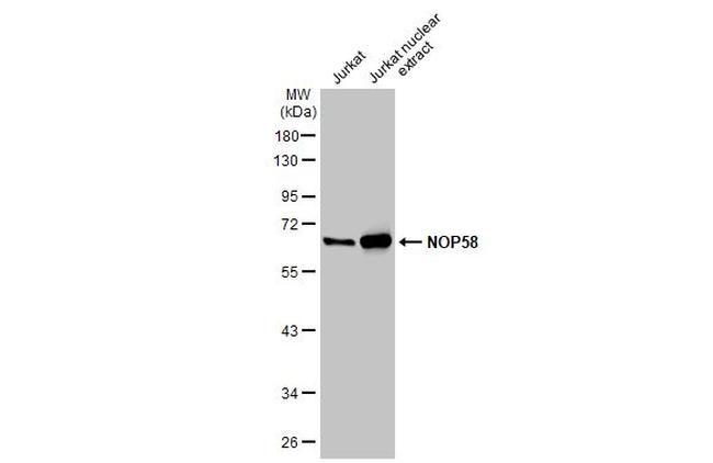 NOP58 Antibody in Western Blot (WB)