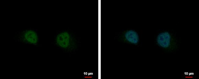 GIT2 Antibody in Immunocytochemistry (ICC/IF)