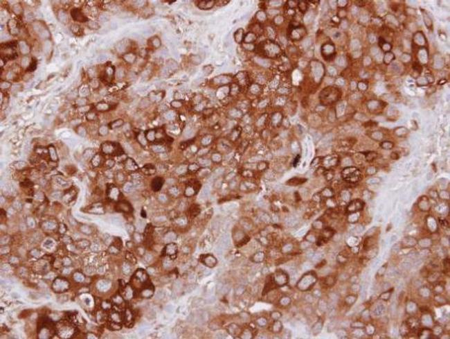 UBASH3A Antibody in Immunohistochemistry (Paraffin) (IHC (P))