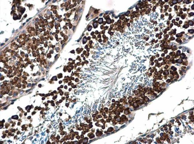 DDX4 Antibody in Immunohistochemistry (Paraffin) (IHC (P))