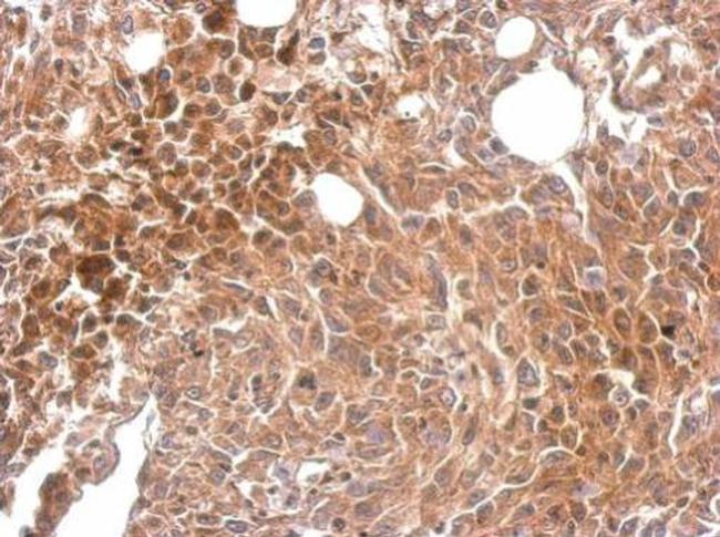 MKS1 Antibody in Immunohistochemistry (Paraffin) (IHC (P))