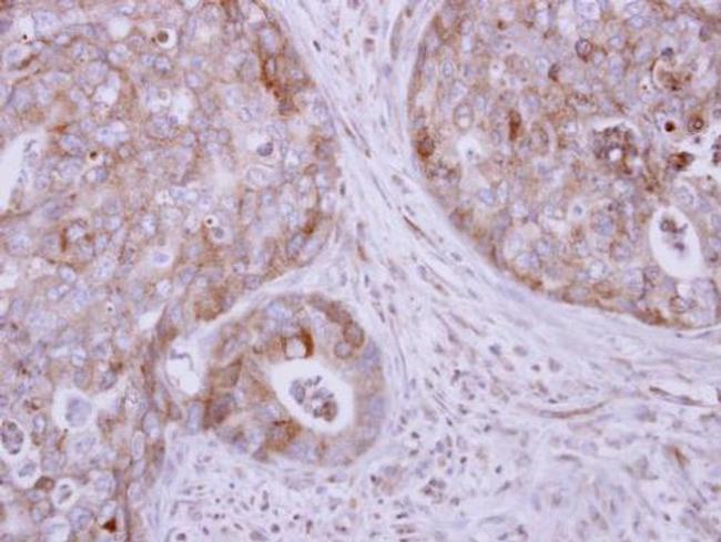 KIF17 Antibody in Immunohistochemistry (Paraffin) (IHC (P))