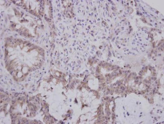 GBA3 Antibody in Immunohistochemistry (Paraffin) (IHC (P))