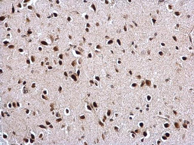 PTBP2 Antibody in Immunohistochemistry (Paraffin) (IHC (P))