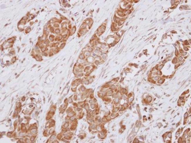 ALS2CR1 Antibody in Immunohistochemistry (Paraffin) (IHC (P))