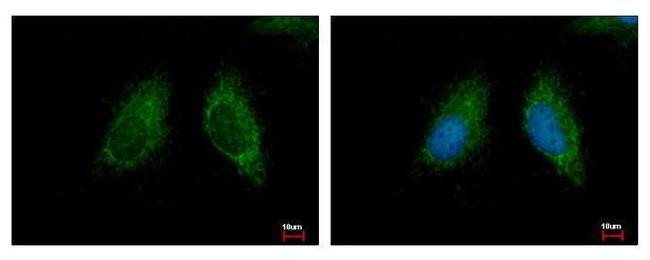 MCCC2 Antibody in Immunocytochemistry (ICC/IF)