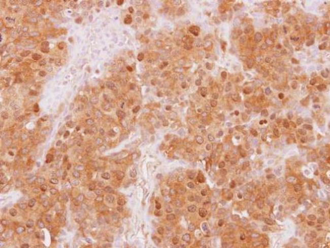 WDR77 Antibody in Immunohistochemistry (Paraffin) (IHC (P))