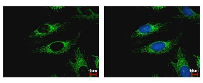 WDR61 Antibody in Immunocytochemistry (ICC/IF)