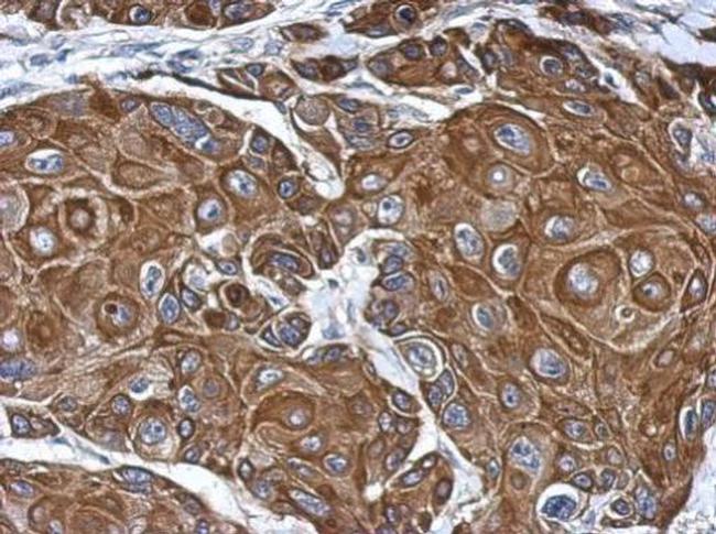 COLEC12 Antibody in Immunohistochemistry (Paraffin) (IHC (P))