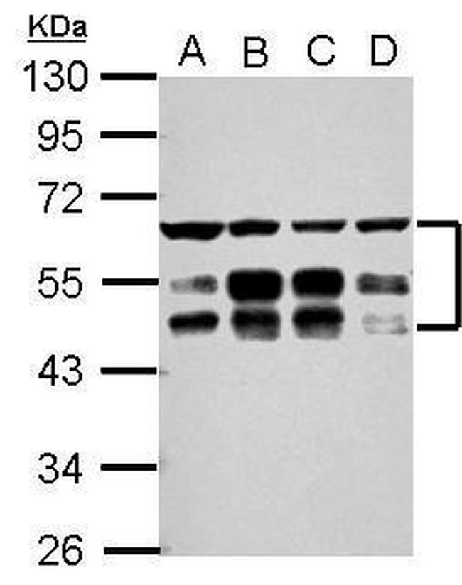 ZFYVE19 Antibody in Western Blot (WB)