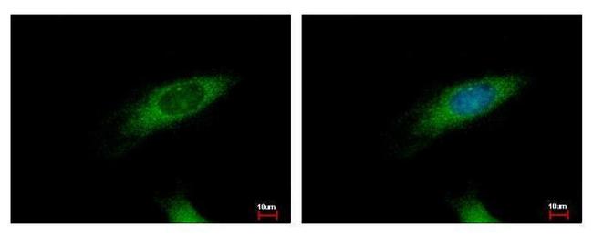 HIP1R Antibody in Immunocytochemistry (ICC/IF)