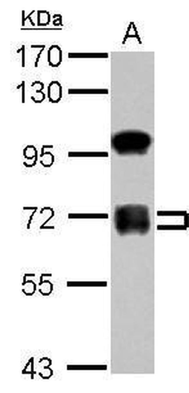 ZNF182 Antibody in Western Blot (WB)