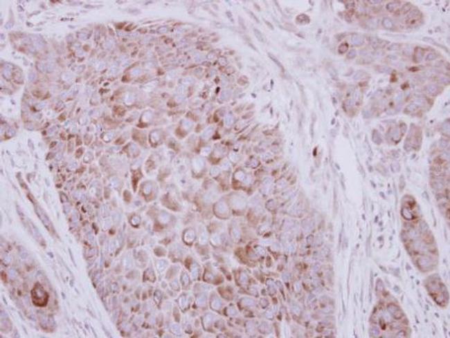 ZP2 Antibody in Immunohistochemistry (Paraffin) (IHC (P))