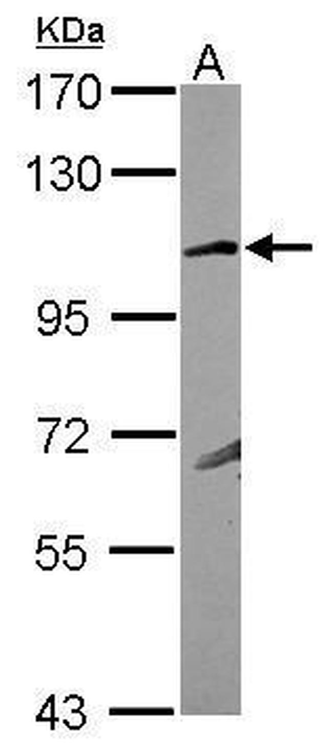 GRIK4 Antibody in Western Blot (WB)