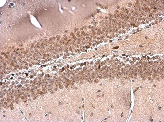 NFIX Antibody in Immunohistochemistry (Paraffin) (IHC (P))