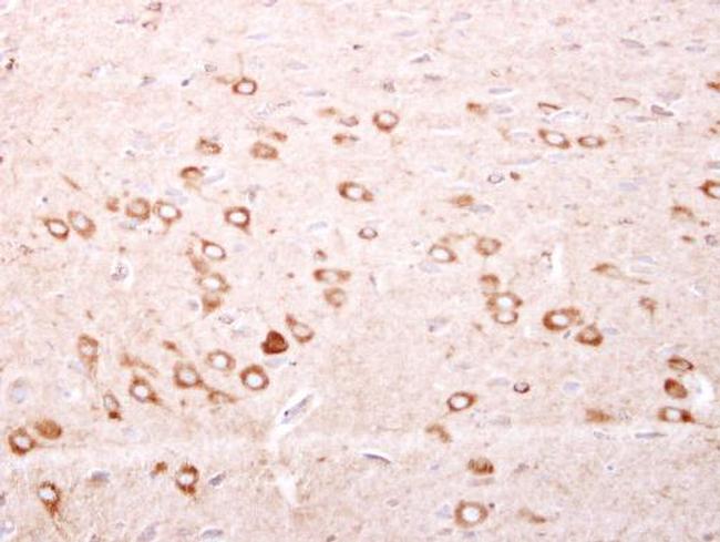 FTMT Antibody in Immunohistochemistry (Paraffin) (IHC (P))