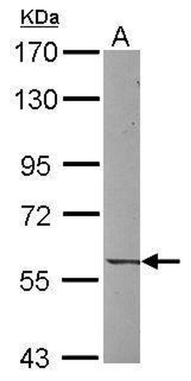 UNC5CL Antibody in Western Blot (WB)