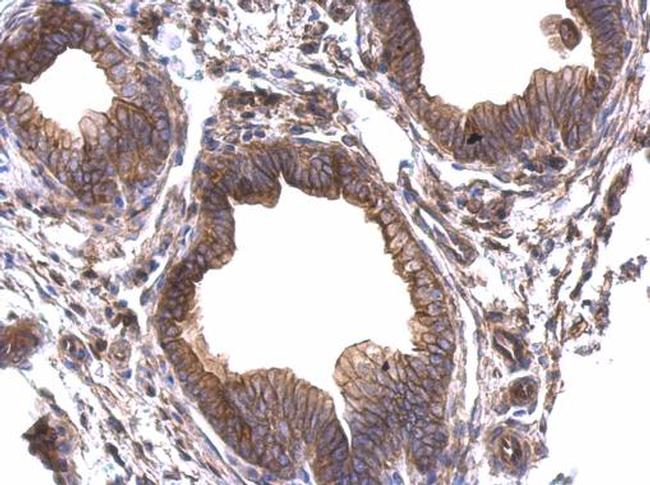 Periplakin Antibody in Immunohistochemistry (Paraffin) (IHC (P))