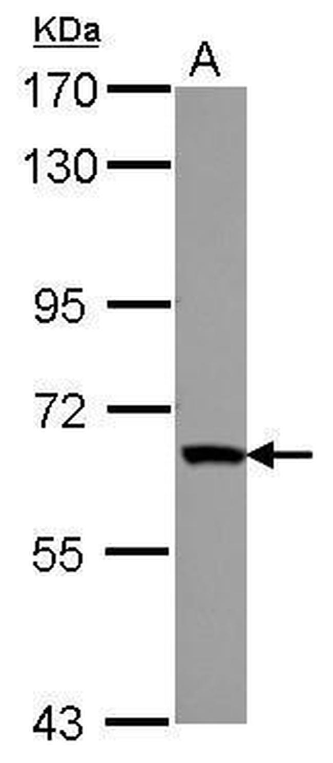 ZNF543 Antibody in Western Blot (WB)