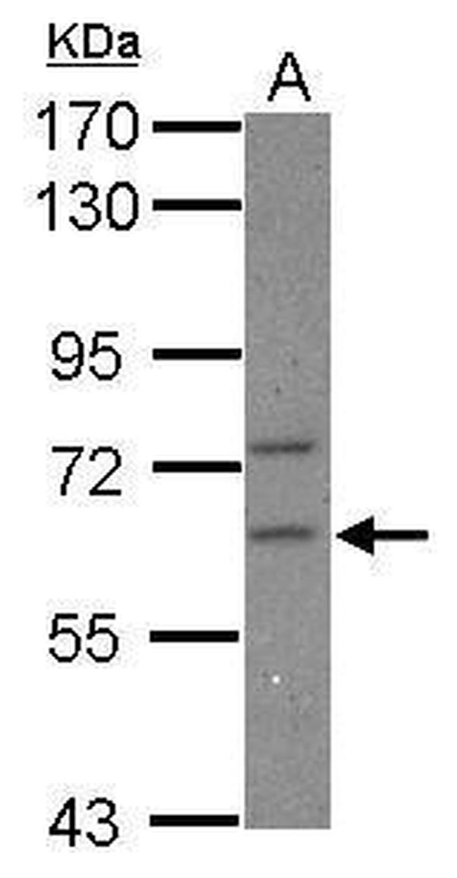 CPEB2 Antibody in Western Blot (WB)