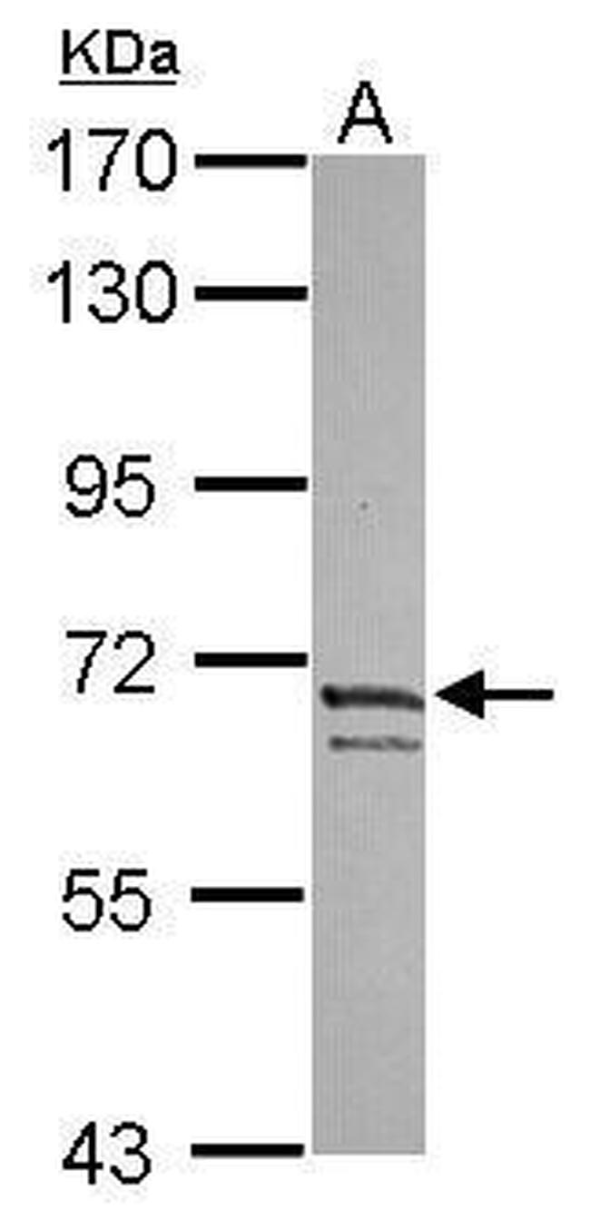 KV4.3 (KCND3) Antibody in Western Blot (WB)