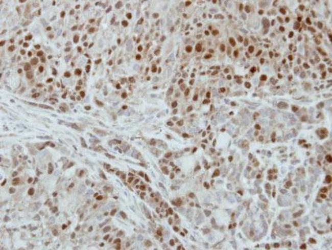 DUT Antibody in Immunohistochemistry (Paraffin) (IHC (P))