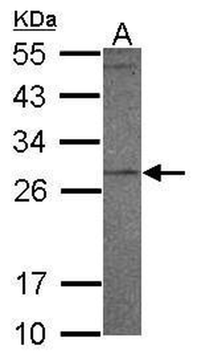 PR3 Antibody in Western Blot (WB)