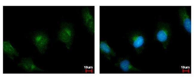 PLA2G4A Antibody in Immunocytochemistry (ICC/IF)