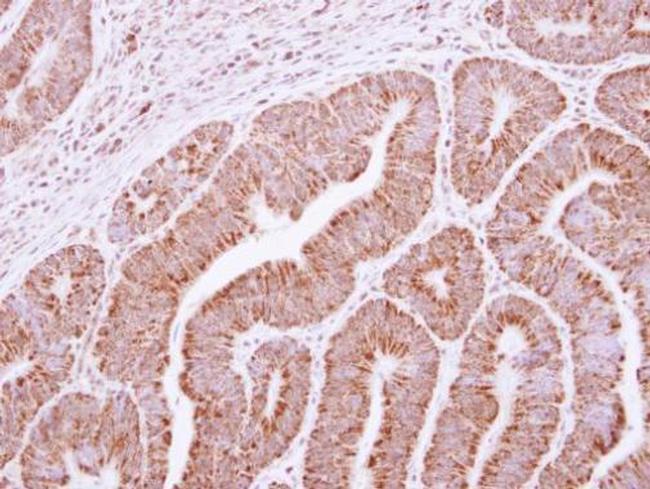 RRP4 Antibody in Immunohistochemistry (Paraffin) (IHC (P))